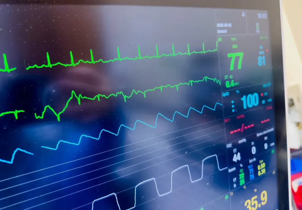 Telemetry
