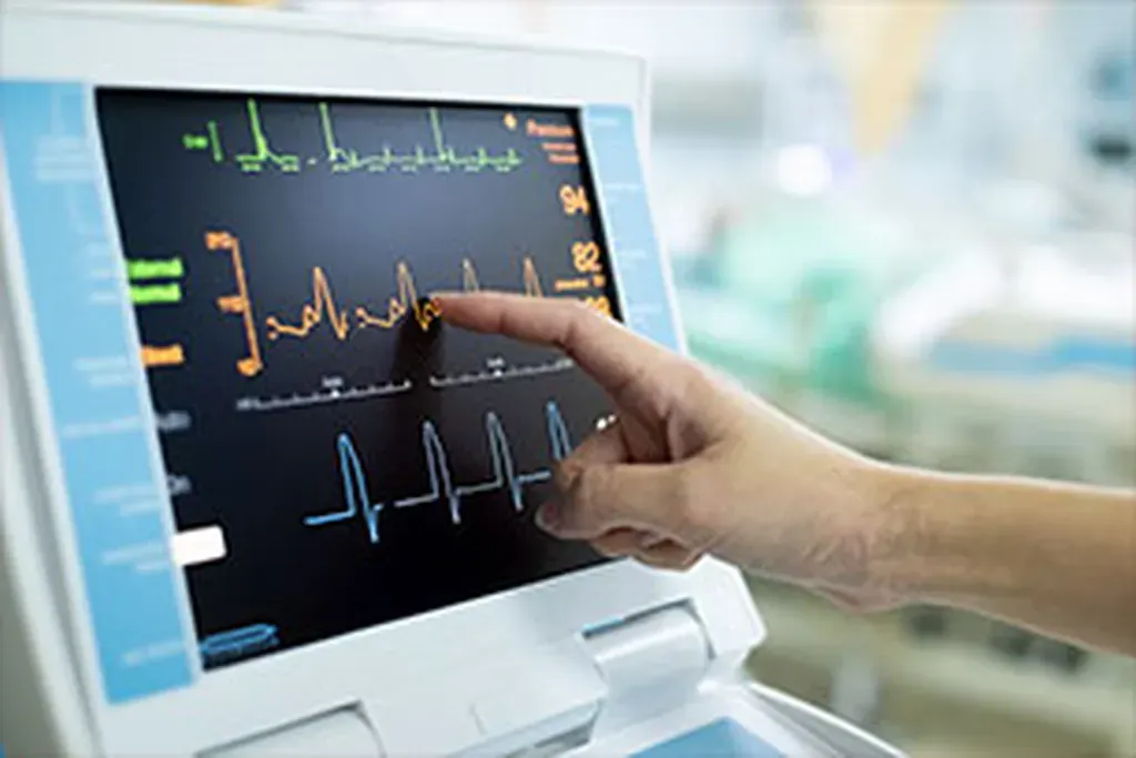EKG