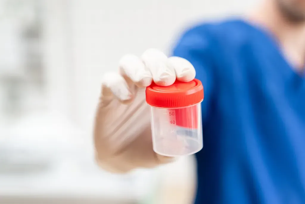 Urine Labs