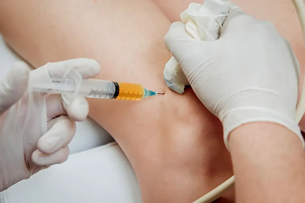 Joint Injections